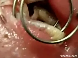 Nude man inserts a lot of worms in his penis during jerk off